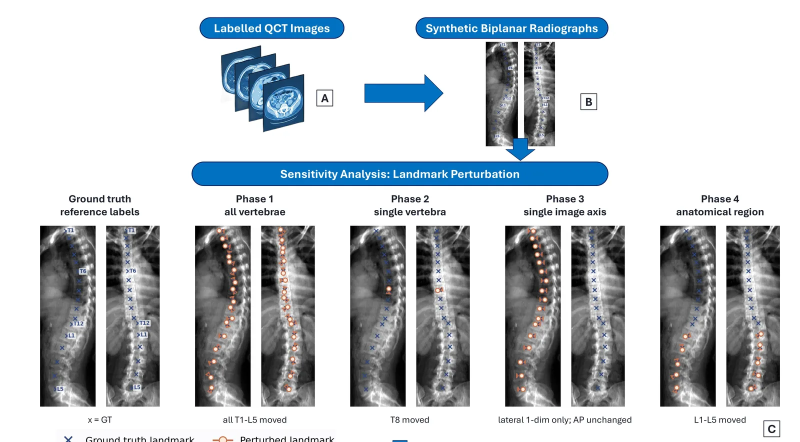 Synthetic biplanar radiographs with ground-truth and perturbed vertebral landmarks across four perturbation phases