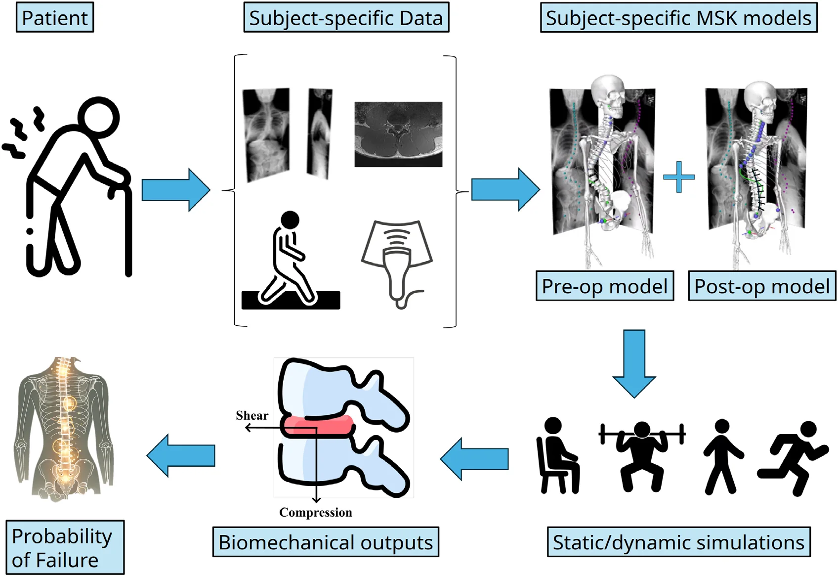Workflow from patient data to pre- and postoperative musculoskeletal models, simulated activities, junctional compression and shear, and probability of failure